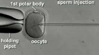 IVF amp ICSI brief overview [upl. by Dric]