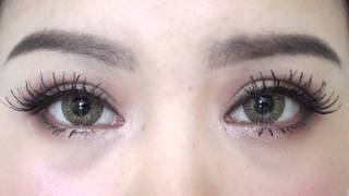 Full Incisional Double Eyelid Blepharoplasty  Epicanthoplasty 5 Months Update [upl. by Larkins]