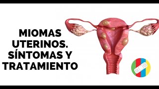 MIOMAS UTERINOS Síntomas y Tratamiento [upl. by Shanie672]