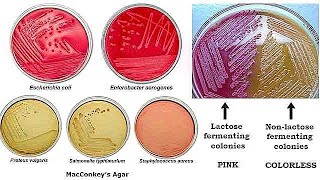 MacConkey Agar [upl. by Inek]