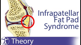 Hoffas Test  Infrapatellar Fat Pad Syndrome [upl. by Yrrehc]