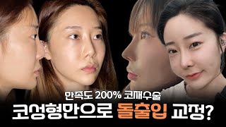 코재수술 흉살 완벽 제거 재수술VLOG😮 [upl. by Reivaxe]