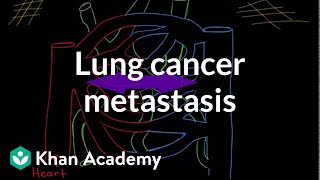 Meet the lungs  Respiratory system physiology  NCLEXRN  Khan Academy [upl. by Philine]