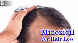 Right way to use MINOXIDIL SOLUTION for HAIR LOSSEXPERT ADVICEDrDeepak P Devakar Doctors Circle [upl. by Jacinta]