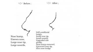 “ ᵛⁱʳᵗᵘᵃˡ ⁿᵒˢᵉ ˢᵘʳᵍᵉʳʸ “  Nose reconstruction subliminal ♡¸• Ultra Effective 🍥 [upl. by Annoik351]