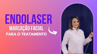 Endolaser  Marcação Facial para o Tratamento [upl. by Robet]