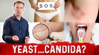 Yeast Infection vs Candida Infection Is there a Difference – DrBerg [upl. by Sidman]