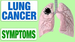 Lung Cancer  All Symptoms [upl. by Yssej]