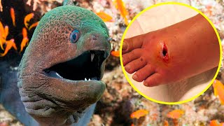 The Most POISONOUS And VENOMOUS FISHES In The World [upl. by Eboj]