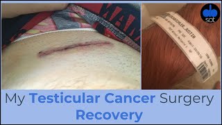 My Testicular Cancer Surgery Recovery [upl. by Schargel]