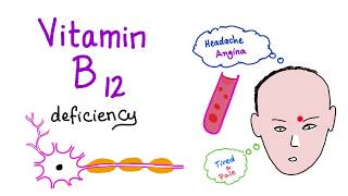 Vitamin B12 Cobalamin Deficiency  Causes Symptoms Diagnosis amp Management  Hematology Series [upl. by Yssim346]