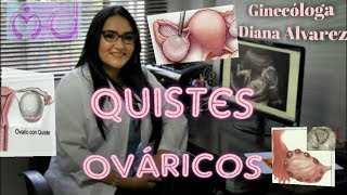 QUISTES OVARICOS POR GINECOLOGA DIANA ALVAREZ [upl. by Eednim]