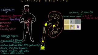 Lithiase urinaire  Docteur Synapse [upl. by Yoshiko]