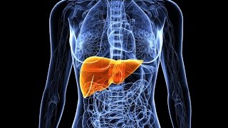 Primary Biliary Cirrhosis [upl. by Mulvihill]