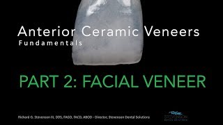 Anterior Ceramic Veneers Part 2 Facial Veneer [upl. by Ailicec]