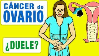 El cáncer de ovario ¿duele [upl. by Netsrik]