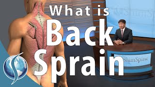 What is a Back Sprain [upl. by Bekha]