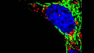 Mitochondrial and lysosomal dynamics [upl. by Fin452]