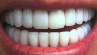 Get Perfectly Straight Teeth―∎ affirmations  Cure Overbite Underbite amp Crossbite [upl. by Etnoid26]