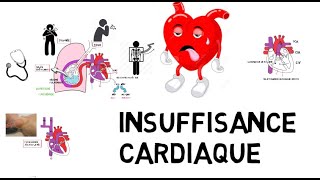 insuffisance cardiaque de A à Z [upl. by Otreblasiul338]