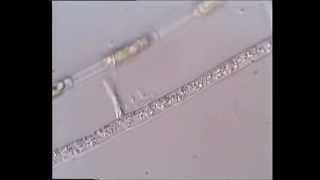 Cytoplasmic streaming in fungal hyphae [upl. by Josepha484]