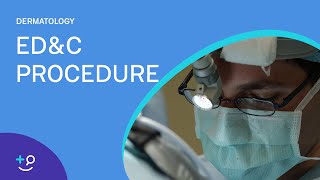 EDampC Procedure Overview Dermatology [upl. by Ellehsor183]