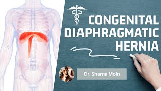 Congenital diaphragmatic hernia CDH types causes mechanism diagnosis amp treatment [upl. by Aicnilav892]