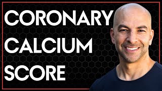 Coronary calcium score what it means and how to interpret your results AMA 5 [upl. by Zilber4]