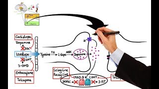 Parkinsons Disease Treatment Options [upl. by Agon]