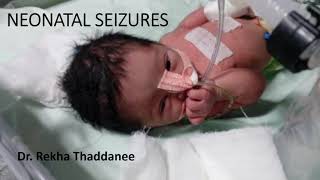 Neonatal Seizures  Pediatrics [upl. by Ahiel974]