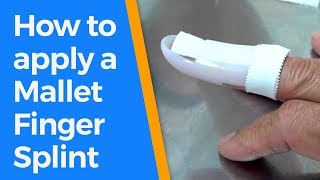 How to apply a Mallet Finger Splint [upl. by Malanie778]