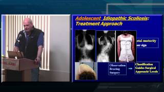 Decision Making in Adult Spinal Deformity [upl. by Saideman]