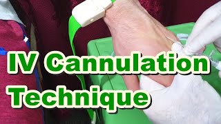 How to Insert IV Cannula  IV Cannulation Technique  Branula  Intravenous Catheter [upl. by Andrea]