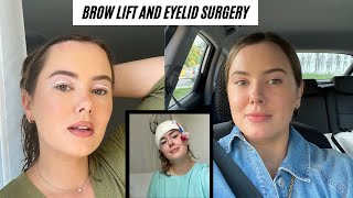 MY EYELID SURGERY AND BROW LIFT  RECOVERY amp RESULTS [upl. by Aleahpar839]