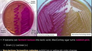 MacConkey Agar [upl. by Aleunamme]