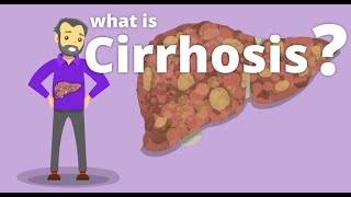 Cirrhosis of Liver  Pathology [upl. by Niawat]