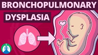 The Easy Way to Understand Congenital Heart Disease 🫀  Cardiology [upl. by Niatsirk]