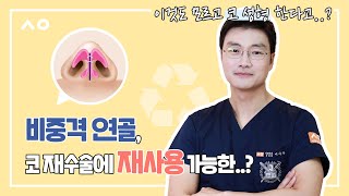 코재수술에서 비중격연골 재사용 가능한가요 [upl. by Knut]