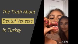 The Truth about Dental Veneers in Turkey [upl. by Paapanen]