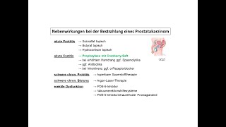 Nehmen Sie das Schmerzmittel Novalgin Beachten Sie diese Nebenwirkungen amp Tipps zu Novaminsulfon [upl. by Lawler]