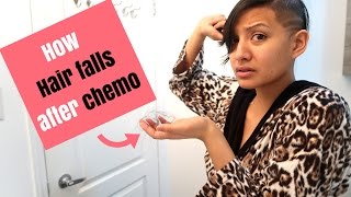 HOW and WHEN hair falls out post chemo [upl. by Ahsineb889]