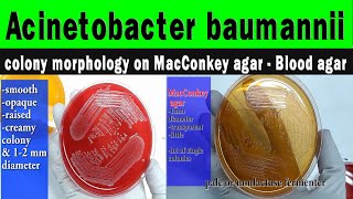 Acinetobacter colony morphology on MacConkey agarBlood agar diagnostic featurespreventive methods [upl. by Anuhsal24]