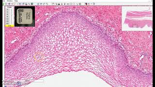 nonkeratinized stratified squamous epithelium [upl. by Aihsaei]