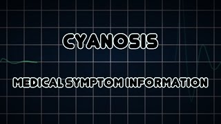 Cyanosis Medical Symptom [upl. by Kolk50]