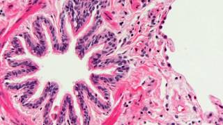 Introduction to Histopathology [upl. by Vaish]