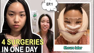 MY PLASTIC SURGERY IN KOREA PART1│FACIAL CONTOURING RHINOPLASTY DOUBLE EYELID SURGERY CONSULTATION [upl. by Alexandria]