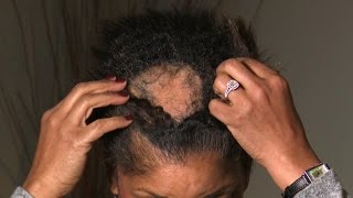 Hair Care Routine How to stop shedding and hair loss  Dr Shereene Idriss [upl. by Akila]