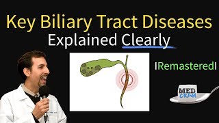 Primary Sclerosing Cholangitis Visual Explanation for Students [upl. by Ntsud961]