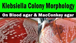 Klebsiella colony morphology on macConkey agar  Blood agar Clear explanation with live video [upl. by O'Rourke884]