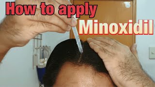 How to apply Minoxidil 5 on scalp Medium Long Hair [upl. by Eneloc556]